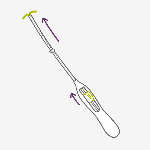 Intrauterine System - IUS stopping Sperm in their Tracks